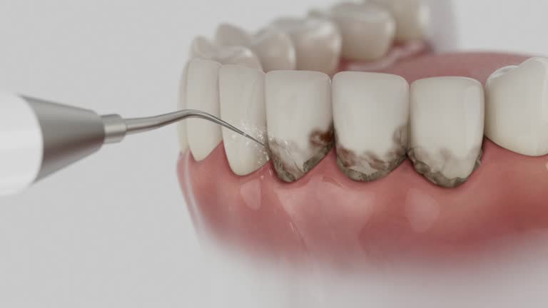 Trusted Tooth Extraction service in Wetherington, OH - Dentist Open Now